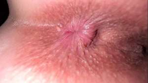 A girl worries that her heavily pigmented anal looks dirty even when it’s clean Is this true?